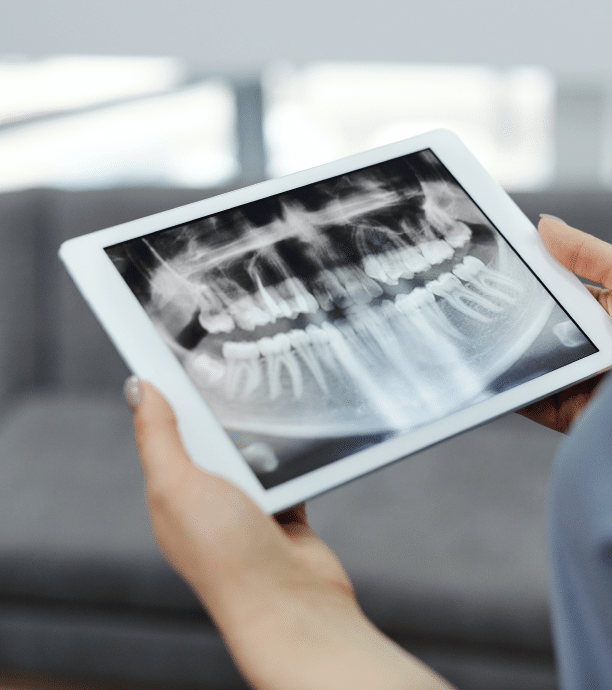 Cone Beam Imaging - Precision Dentistry of Howard